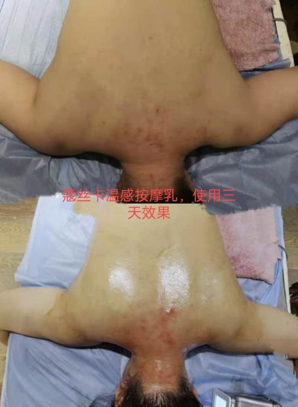 頸椎有救了！蔻絲卡溫感滋養(yǎng)按摩精華乳，每天涂一涂疲勞全掃光